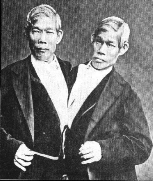 Siamese twins Chang & Eng